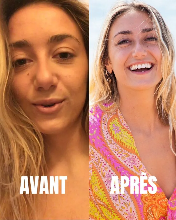 Cortisol avant après