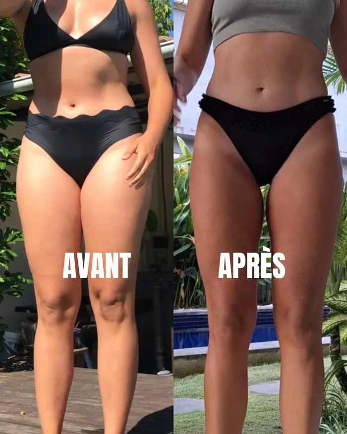 Rétention d'eau avant après
